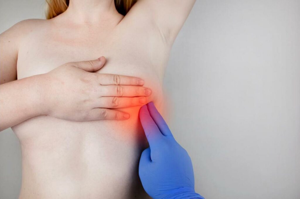 Ultimate Guide to Breast Pain