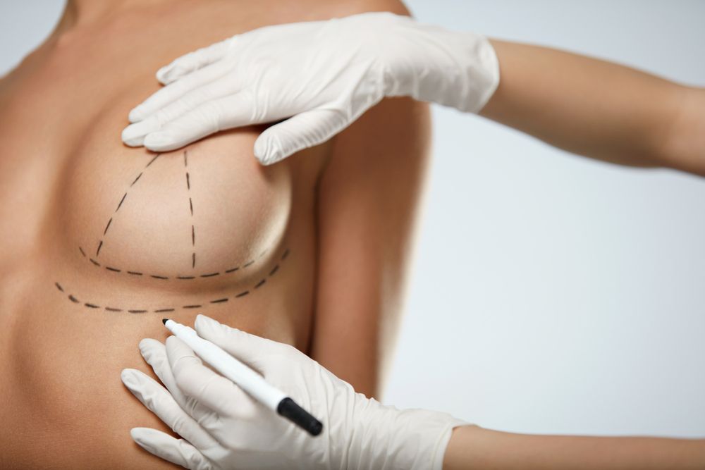 breast implant surgery