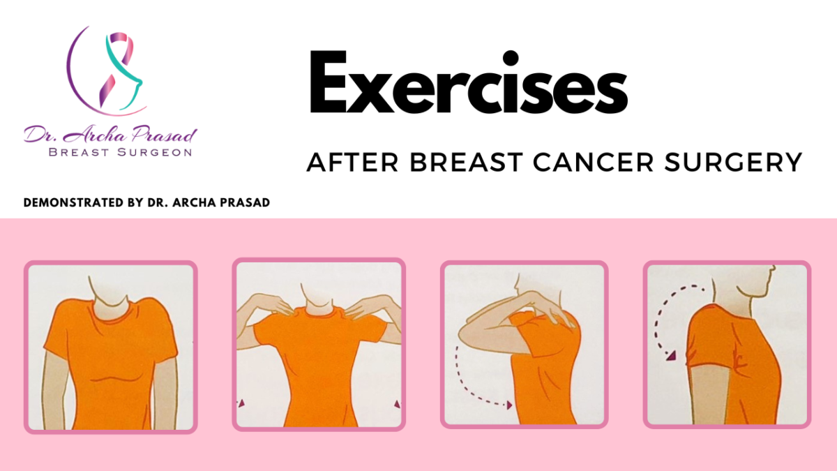 Exercises after Breast Cancer Surgery